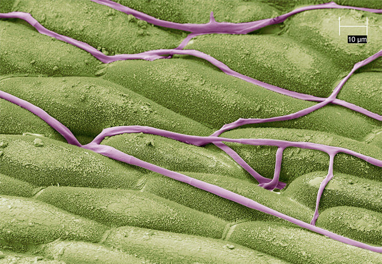 Michrodochium hyphae penetrating stomata of untreated leaf surface
